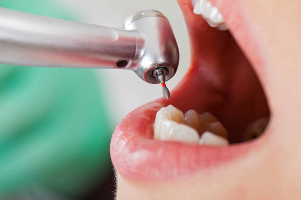 Best Cosmetic Emergency Dentistry in Cloverdale, VA